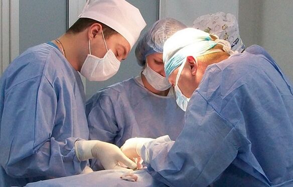 hirurško liječenje proširenih vena