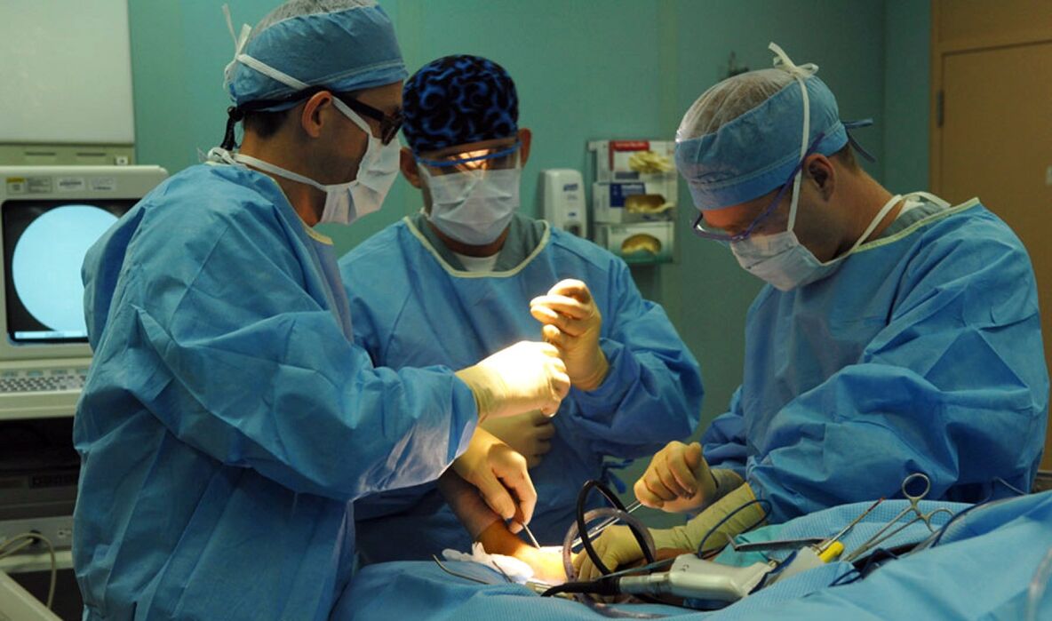 hirurško liječenje proširenih vena