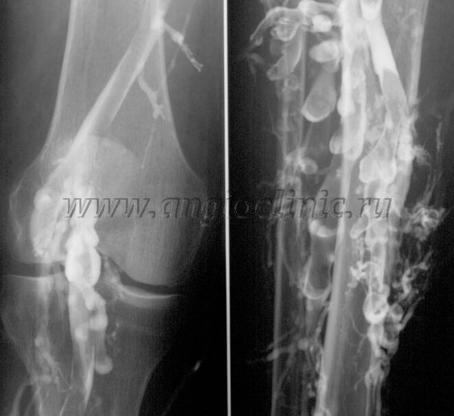 Ultrazvučno skeniranje